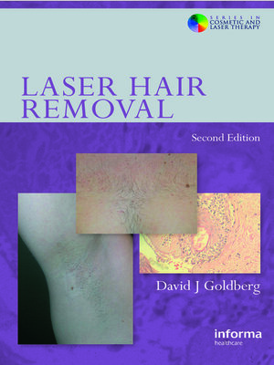 cover image of Laser Hair Removal
